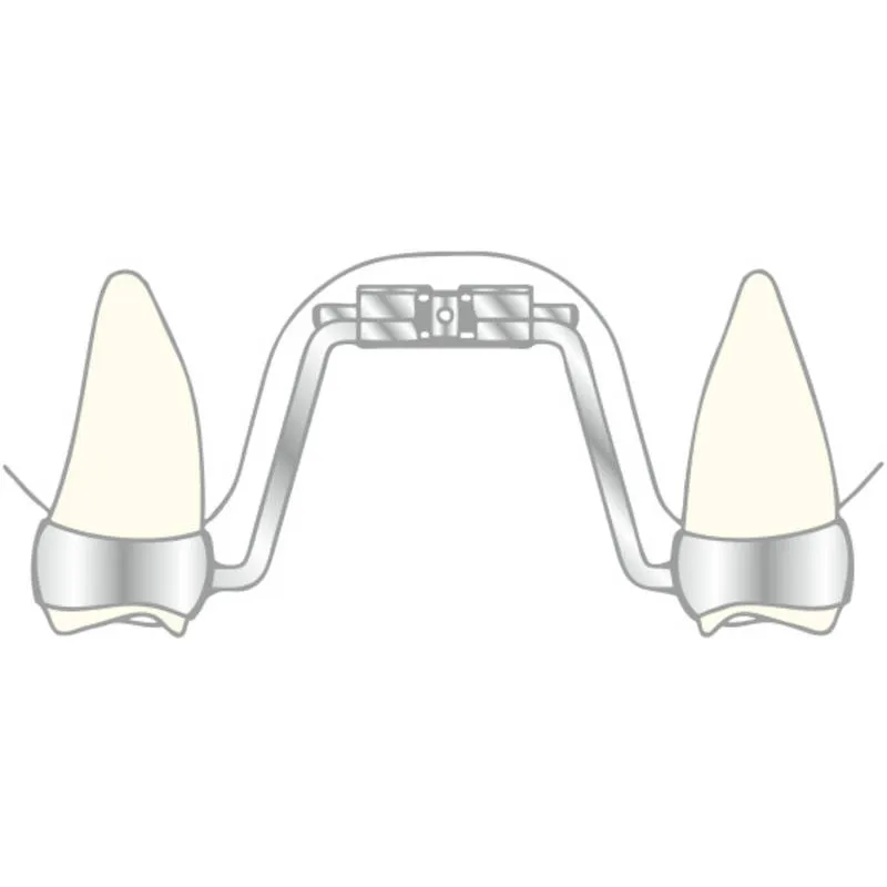 VECTOR 600, Skeletal Expanders, 9mm, PK/10
