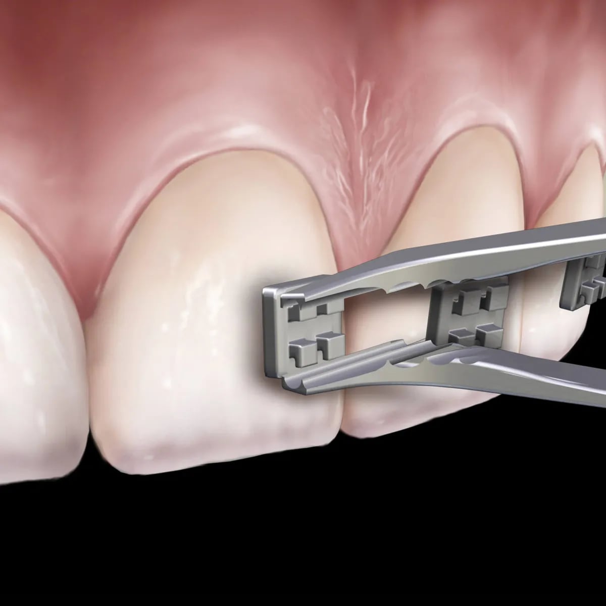 Slim Direct Bond Bracket Holding Tweezer
